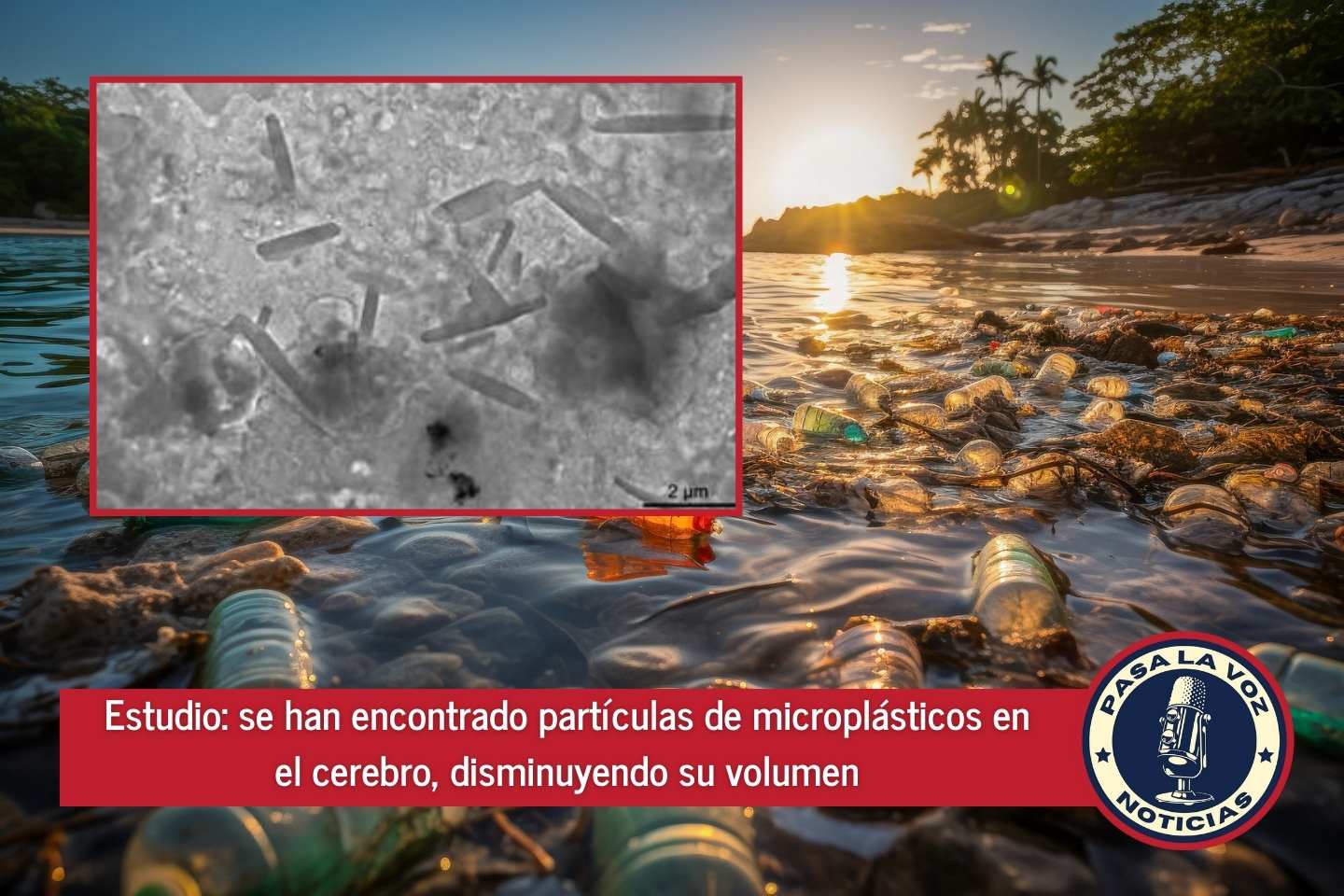 Estudio se han encontrado partículas de microplásticos en el cerebro, disminuyendo su volumen